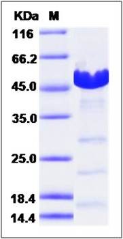 SDS-PAGE analysis of BRCA2 protein