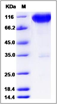 SDS-PAGE analysis of Rat TrkA protein