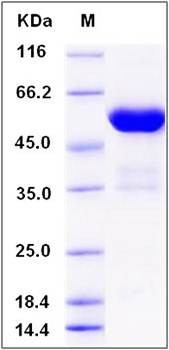 SDS-PAGE analysis of human FKBP7 protein