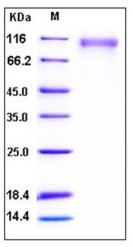 SDS-PAGE analysis of human SLITRK1 His tag protein