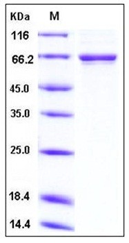 SDS-PAGE analysis of human TGFBI His tag protein