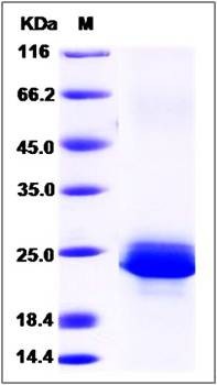 SDS-PAGE analysis of human SRGN protein (His Tag)