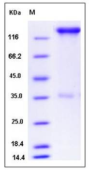 SDS-PAGE analysis of human SELP protein