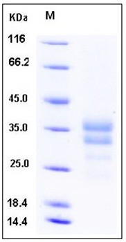 SDS-PAGE analysis of Human IGFBP7 His tag protein