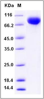 SDS-PAGE analysis of Human IL2RG protein