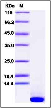 SDS-PAGE analysis of mouse EGF protein (Native)