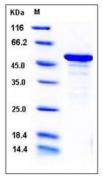 SDS-PAGE analysis of human ANP32A His GST tag protein