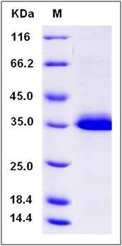 SDS-PAGE analysis of Cynomolgus IGFBP1 protein (His Tag)