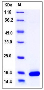 SDS-PAGE analysis of Mouse PLA2G1B His tag protein