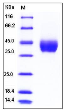 SDS-PAGE analysis of mouse CFD His tag protein