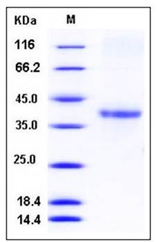 SDS-PAGE analysis of human ACRV1 His tag protein