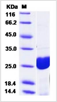 SDS-PAGE analysis of Human HPGDS protein (His Tag)
