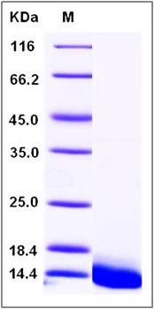 SDS-PAGE analysis of human DEFB103A protein (His Tag)