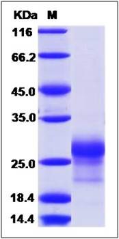 SDS-PAGE analysis of CD8B protein