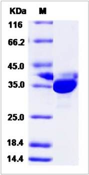SDS-PAGE analysis of Human PRPS2 protein (His Tag)