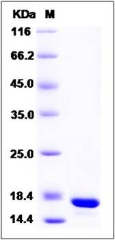 SDS-PAGE analysis of human GCSH protein (His Tag)