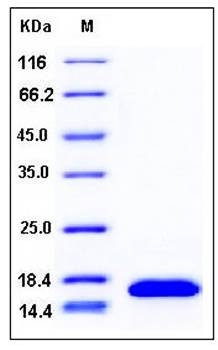 SDS-PAGE analysis of human CST2 His tag protein