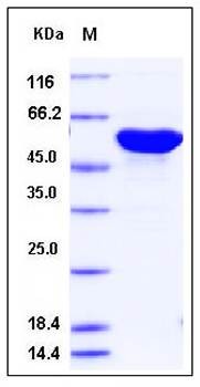 SDS-PAGE analysis of H2N2 NP protein (His Tag)