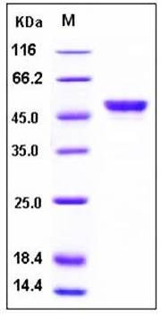 SDS-PAGE analysis of human CA9 His tag protein