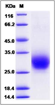 SDS-PAGE analysis of Human RAMP3 protein