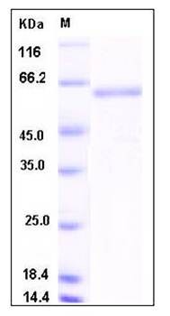 SDS-PAGE analysis of mouse SMPD1 protein (His Tag)