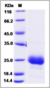 SDS-PAGE analysis of Cynomolgus CD160 protein