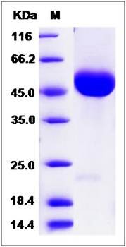SDS-PAGE analysis of Rat VEGF-C protein (His Tag)
