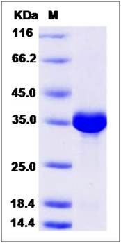 SDS-PAGE analysis of Human NUDT5 protein (His Tag)