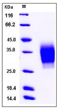 SDS-PAGE analysis of Human PTH1R His tag protein