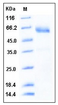 SDS-PAGE analysis of human SMOC1 His tag protein