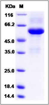 SDS-PAGE analysis of human TMED1 protein
