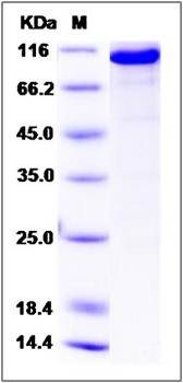 SDS-PAGE analysis of human CASK protein