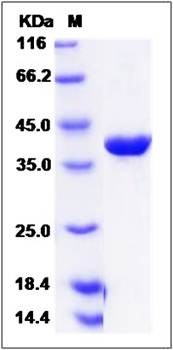 SDS-PAGE analysis of human SAE1 protein