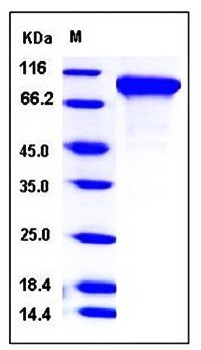 SDS-PAGE analysis of Human NLGN1 His tag protein