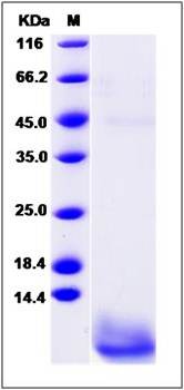 SDS-PAGE analysis of human CARTPT protein