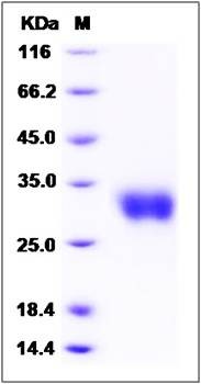 SDS-PAGE analysis of Mouse IFNB1 protein