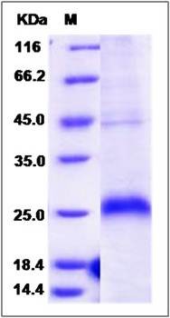 SDS-PAGE analysis of human CD27 protein (His Tag)