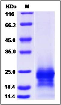 SDS-PAGE analysis of PRAP1 (His Tag) protein