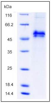 SDS-PAGE analysis of human Fst His tag protein