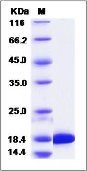 SDS-PAGE analysis of Human RBP5 protein (His Tag)