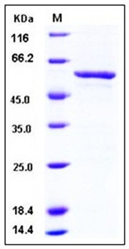SDS-PAGE analysis of human SMYD3 GST tag protein