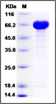 SDS-PAGE analysis of E.coli BirA protein (MBP Tag)