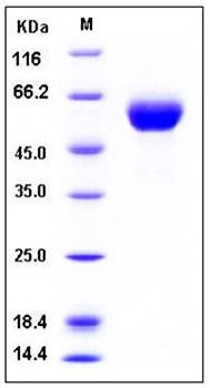 SDS-PAGE analysis of Human DDR1 His tag protein