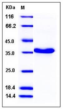 SDS-PAGE analysis of human C1QBP His tag protein