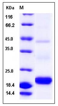 SDS-PAGE analysis of Human PDGF-C protein (His Tag)