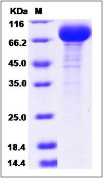 SDS-PAGE analysis of Canine IL18R1 protein