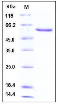SDS-PAGE analysis of Human DAN Fc tag protein