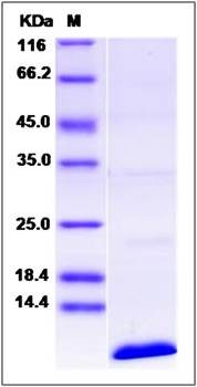 SDS-PAGE analysis of human CD81 protein