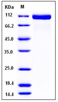 SDS-PAGE analysis of mouse ACE2 His tag protein