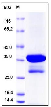 SDS-PAGE analysis of human DCX protein (GST Tag)